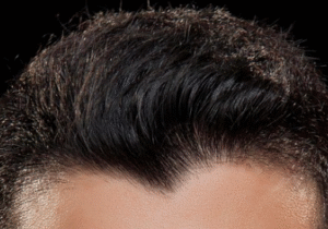 Widow's peak on dark brown straight hair.